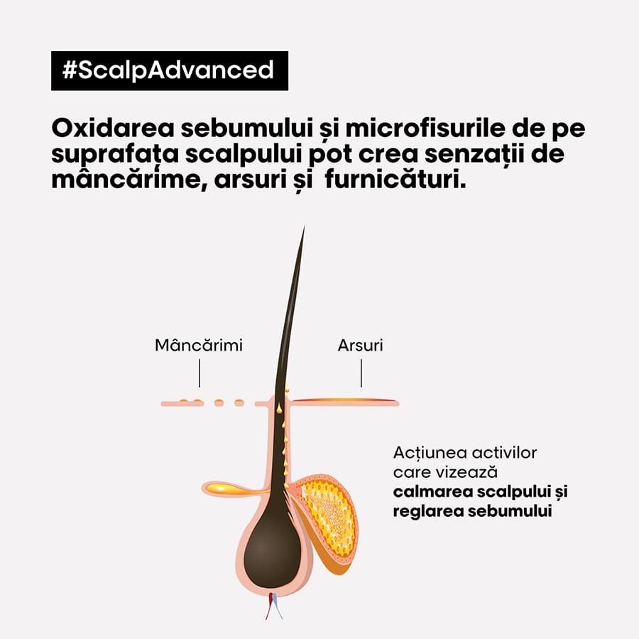 Scalp Advanced, cu Niacinamide Tratament