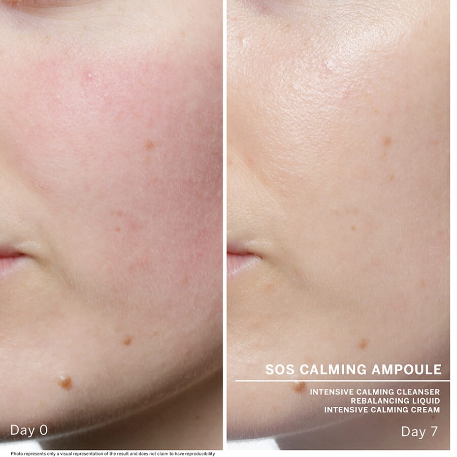 Ampoule Concentrates SOS Calming