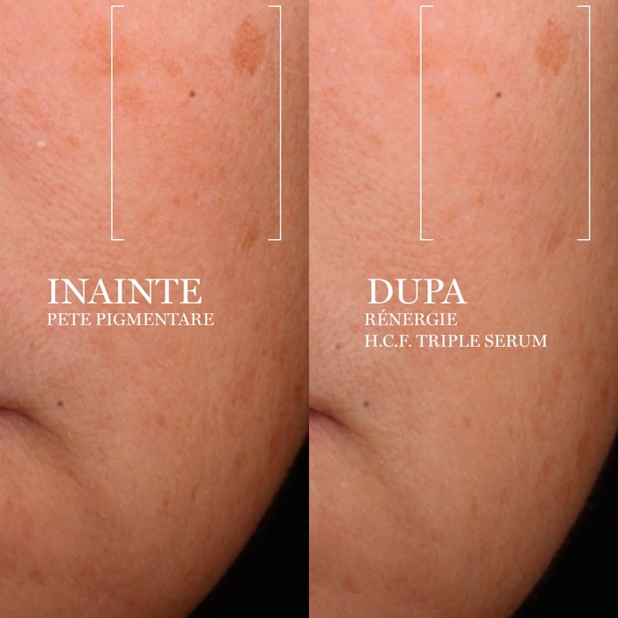 Rénergie H.C.F. Triple Serum