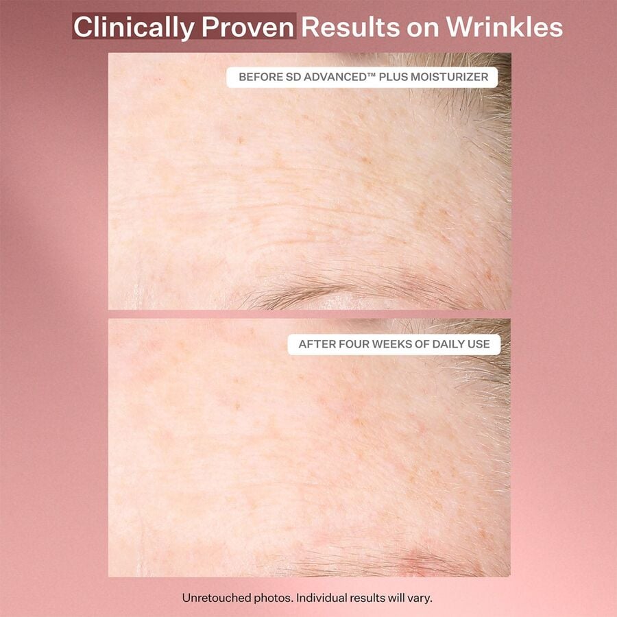 Sd Advanced™ Plus Intensive Moisturizer