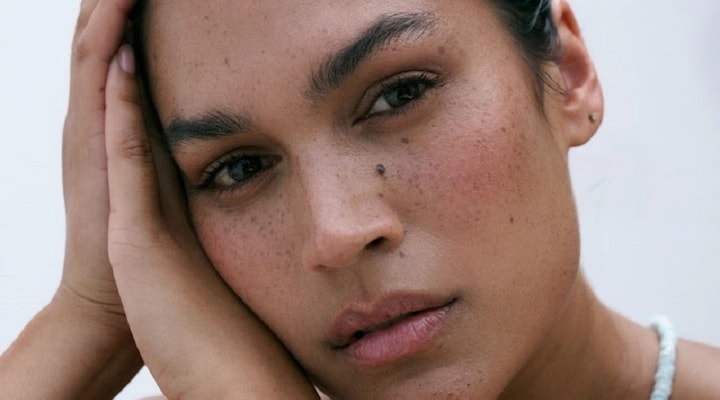 Imagine implicită pentru cms