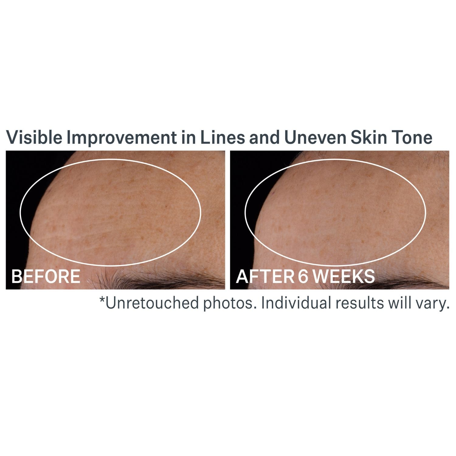 Advanced Retinol Nightly Multi-Correct Serum