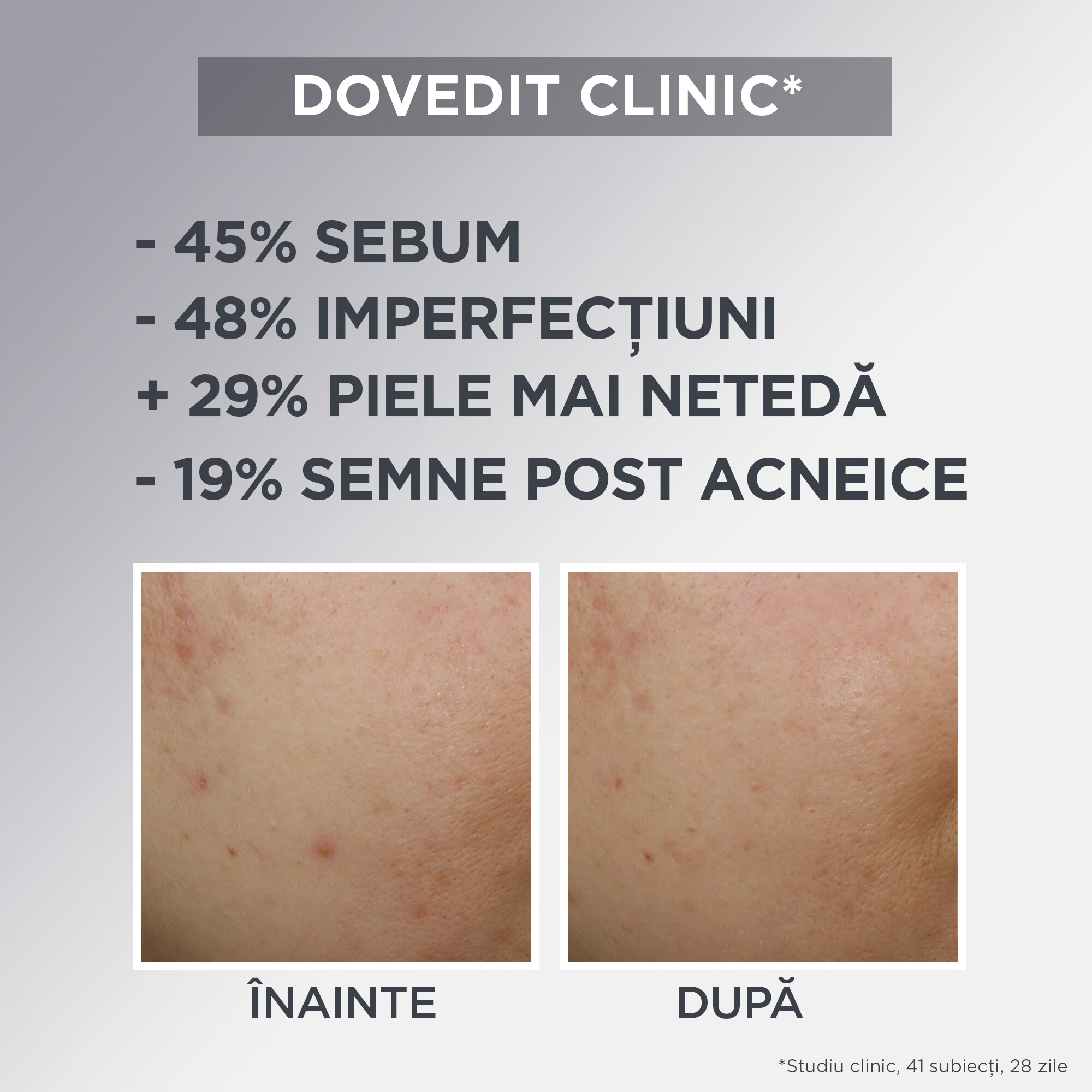 G Skin Nat Daily Mattifying Air Cream