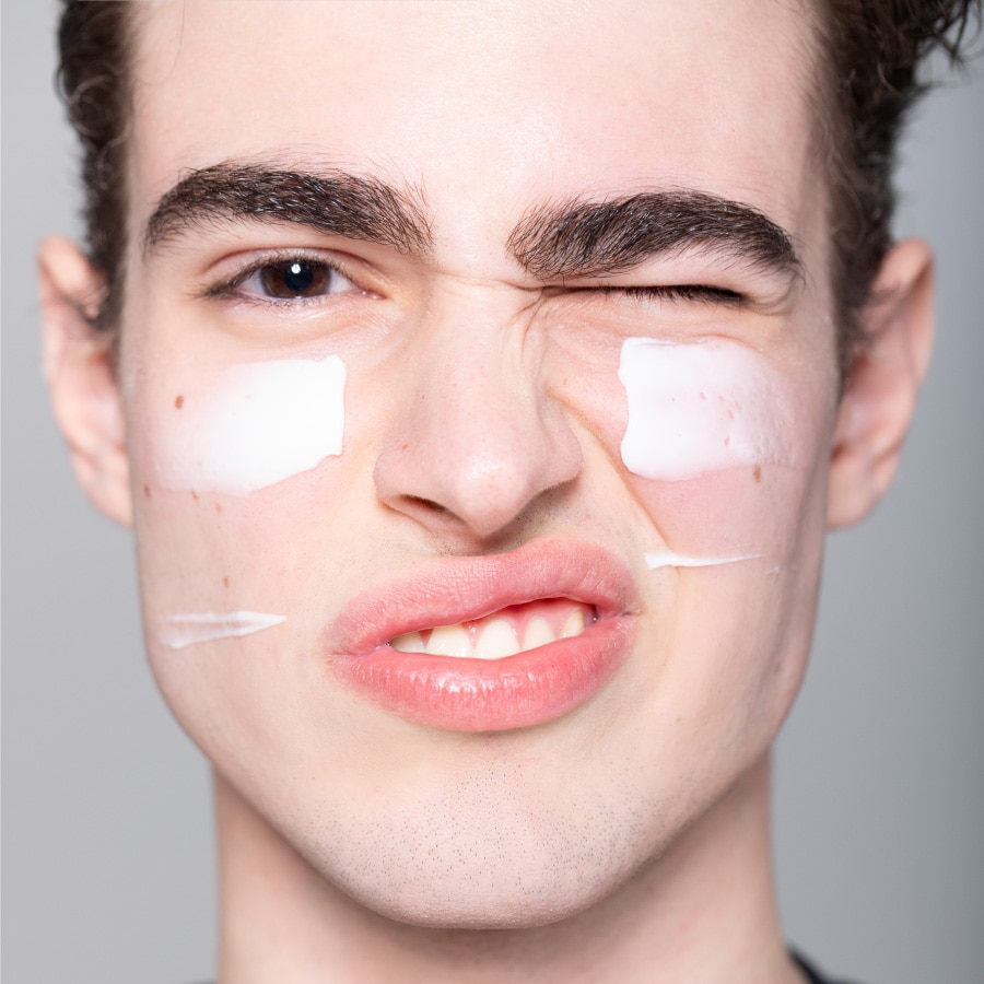 Afc Acne Face Cream Refill