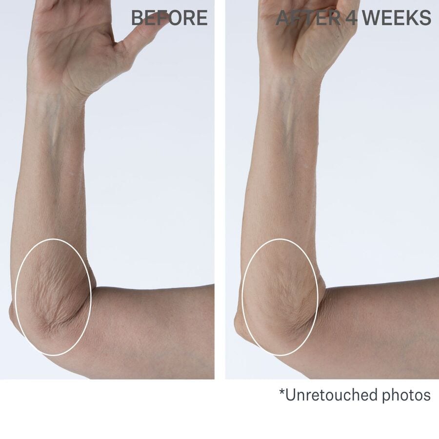 Crepe Control Tightening Body Cream