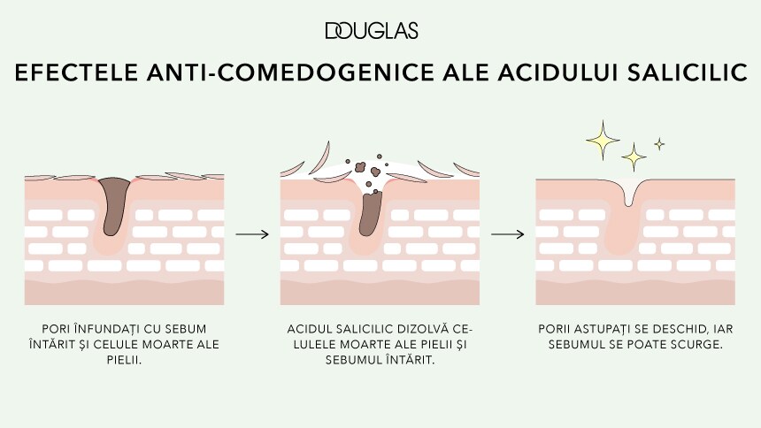 Imagine implicită pentru cms