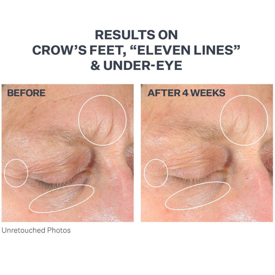 Intensive Eye Plus Concentrate For Wrinkles