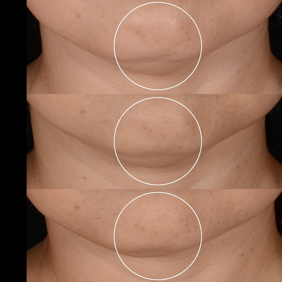 Rénergie H.P.N.  300 Peptide Cream