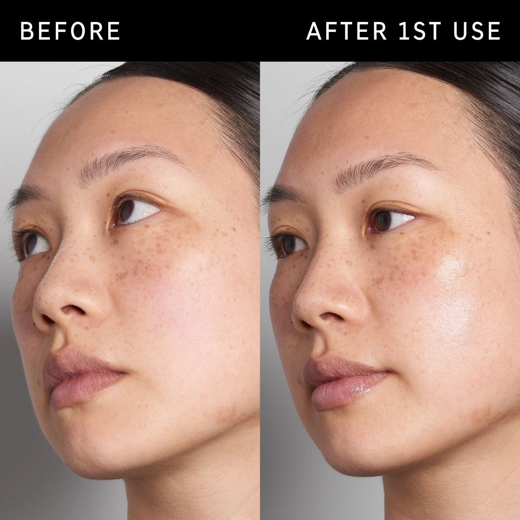 Hyaluronic Acid Serum