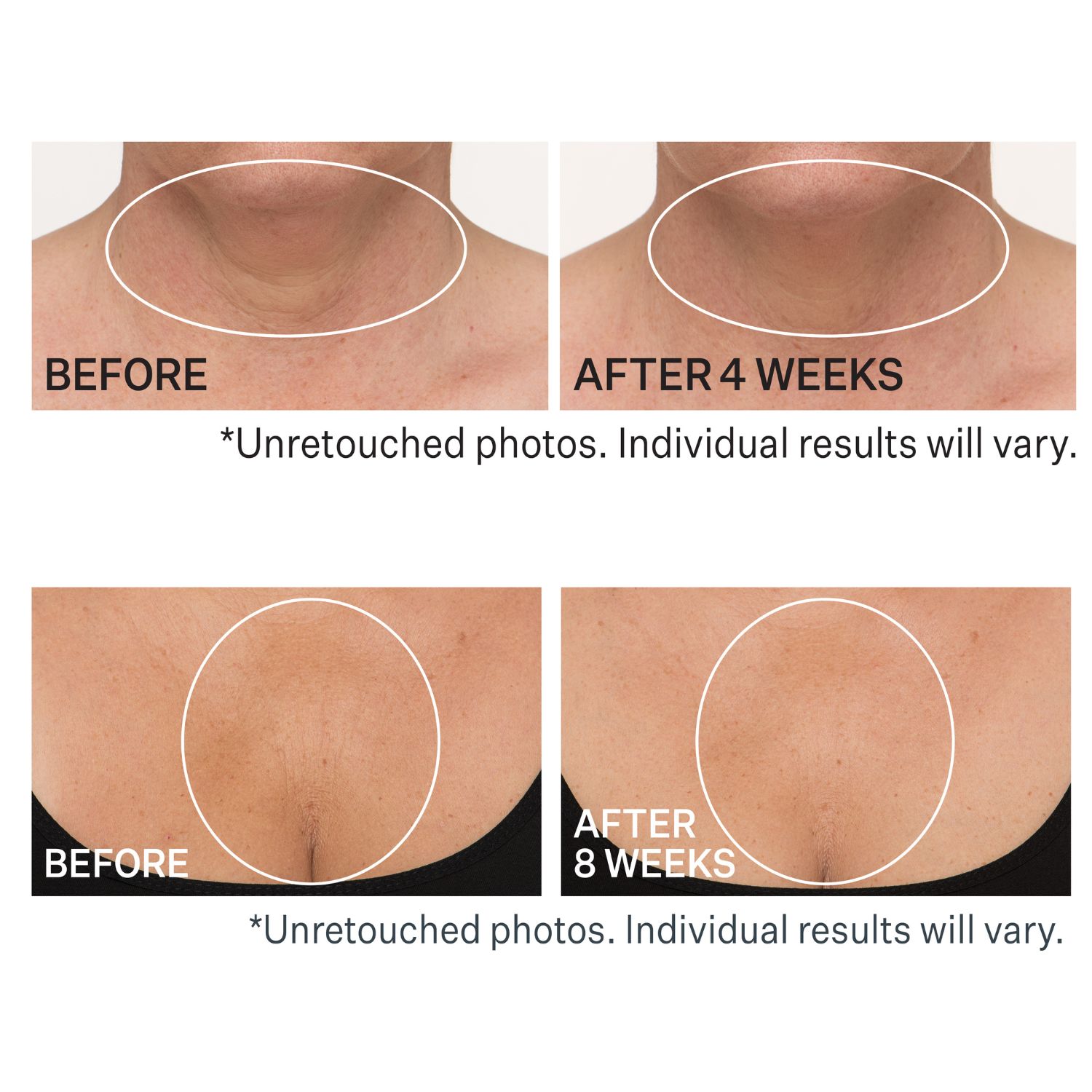 Tl Advanced Tightening Neck Cream Plus With Peptides