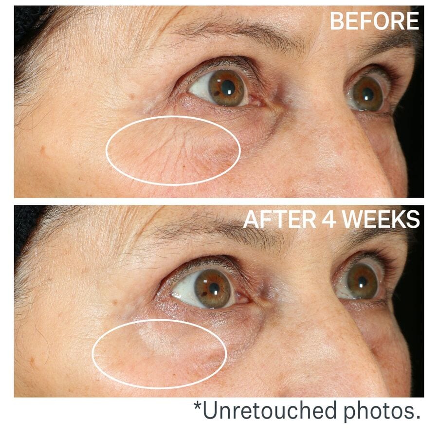 Peptight™ 360 Tightening Eye Serum