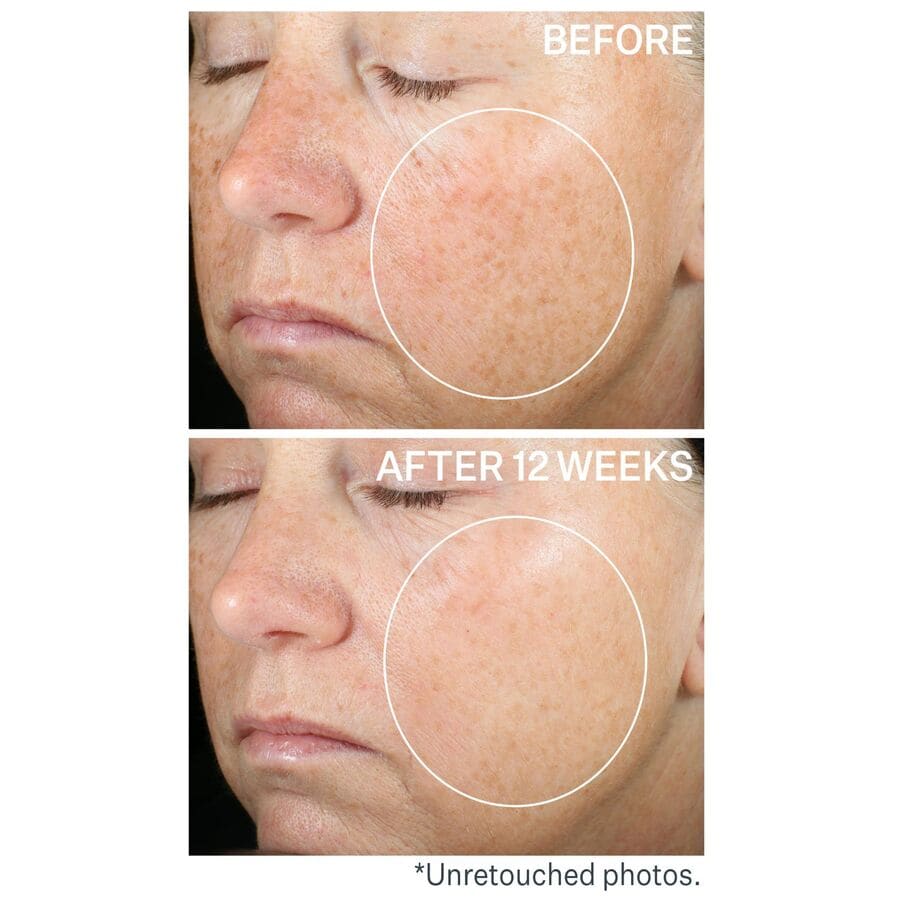 Super-C Retinol Brightening & Correcting Serum