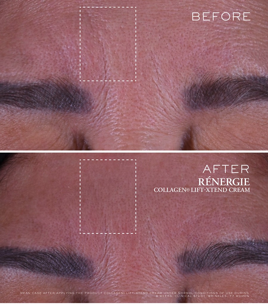 Rénergie Collagen+ Lift-Xtend  Cream