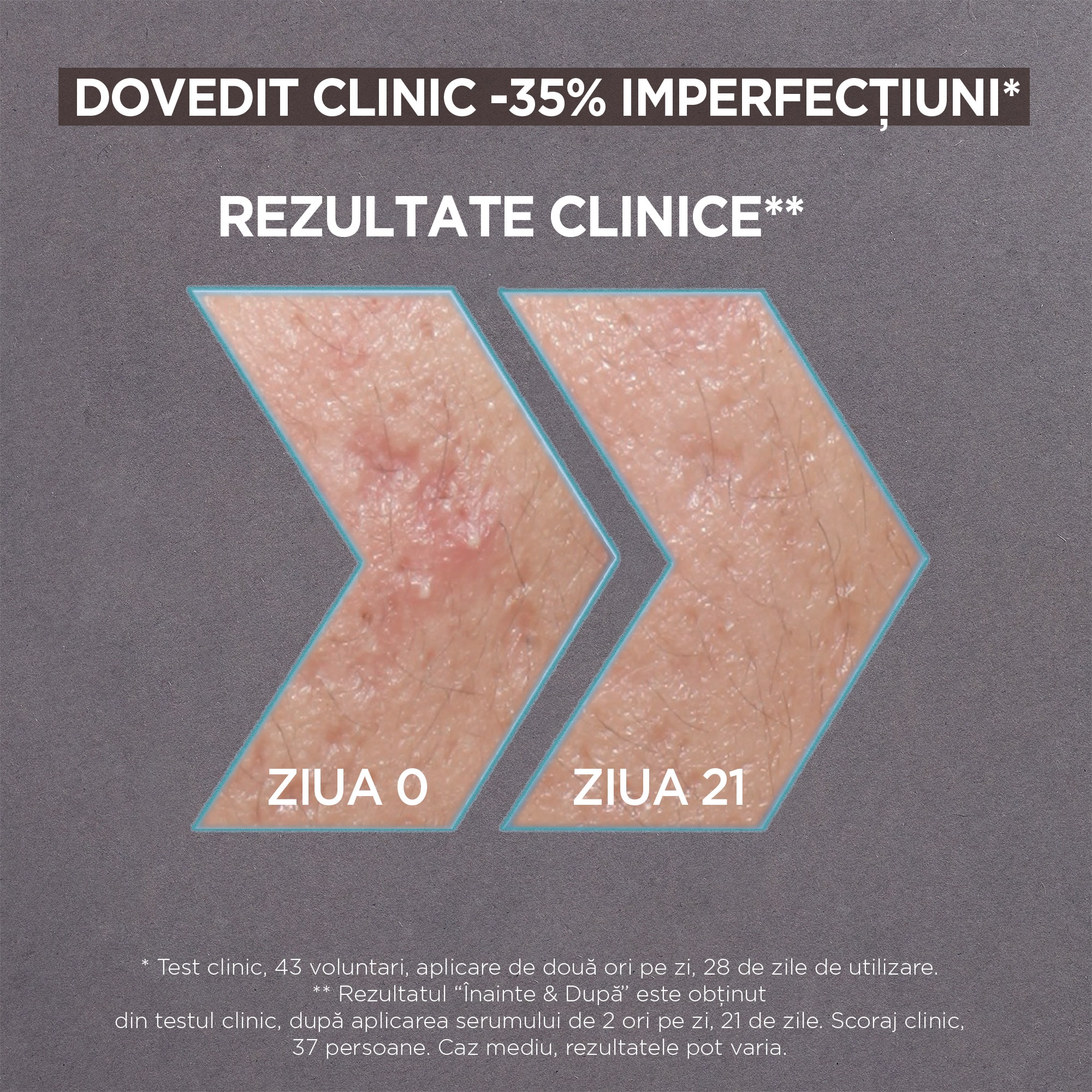 AHA + BHA Charcoal Serum