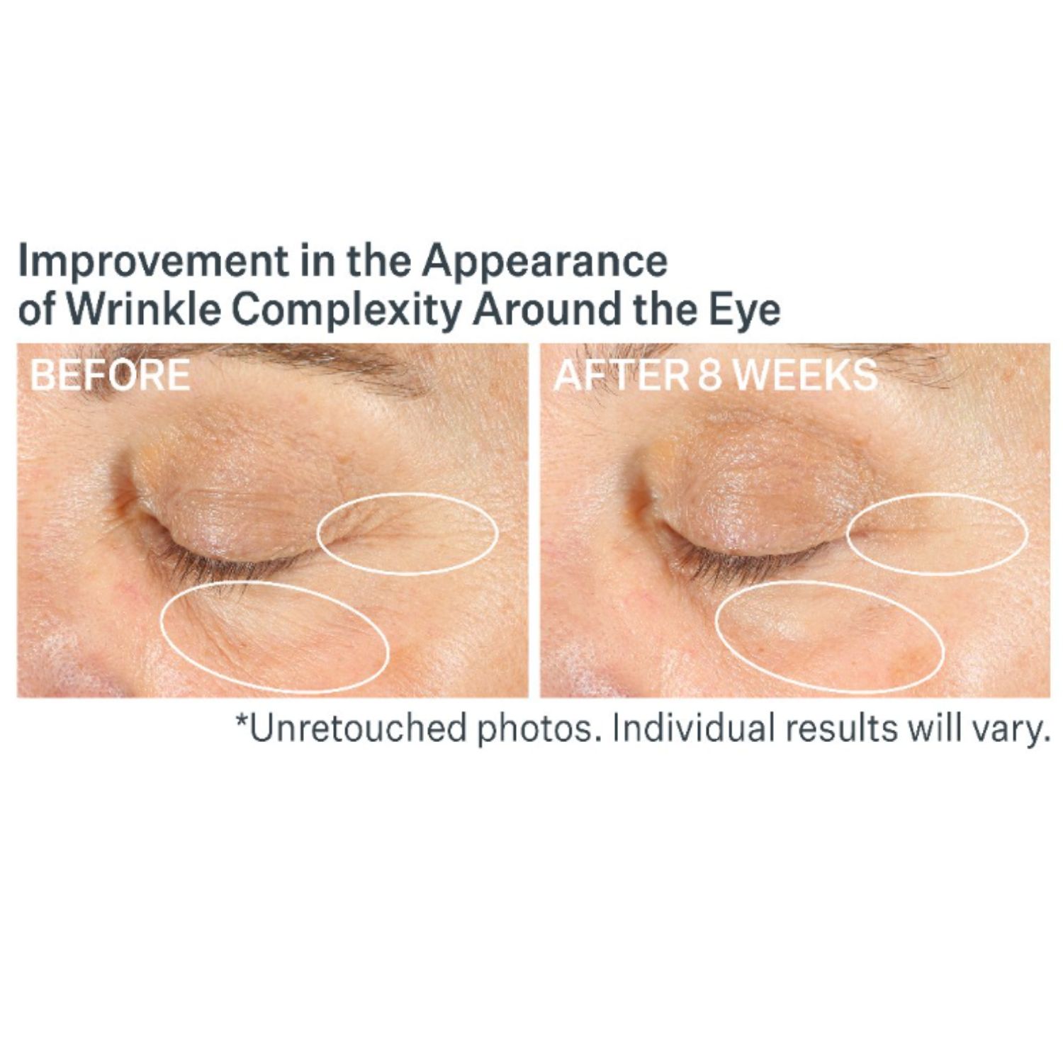 Advanced Retinol Multi-Correct Eye Cream