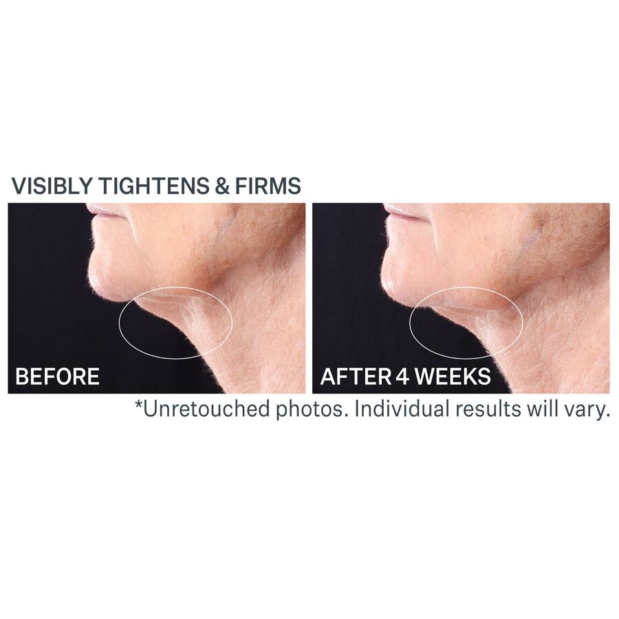 Tightening Neck Serum With Roller