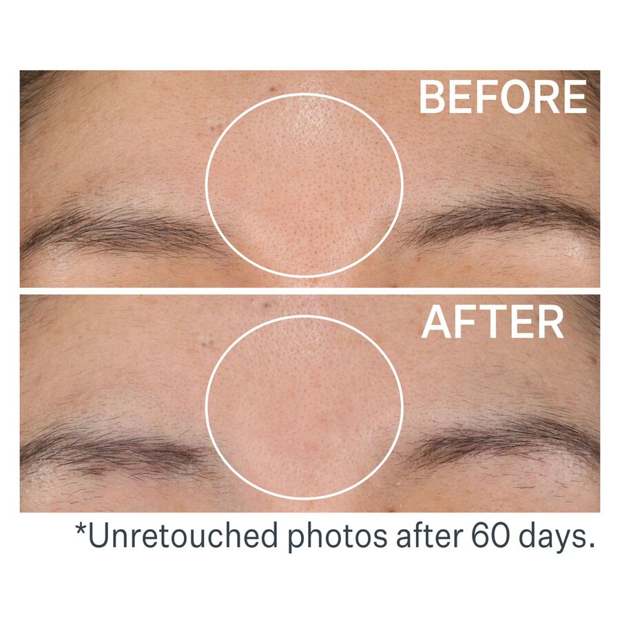 Daily Reveal™ Exfoliating Pads