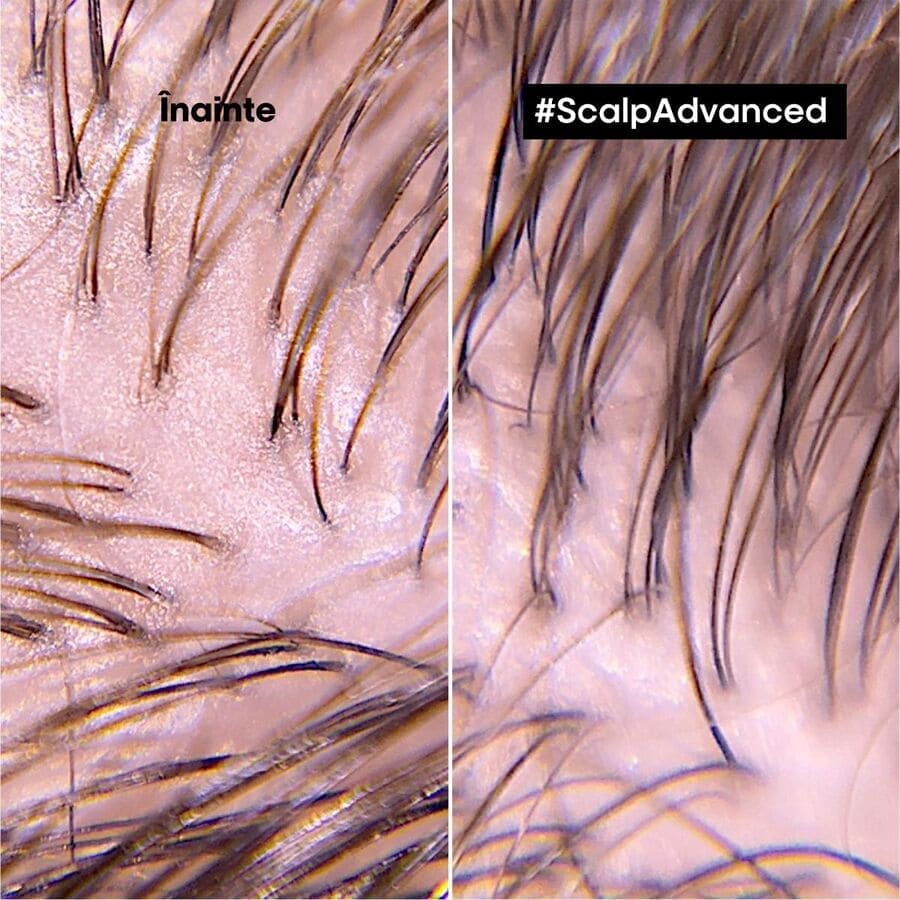Scalp Advance with 6% argila 2 in 1
