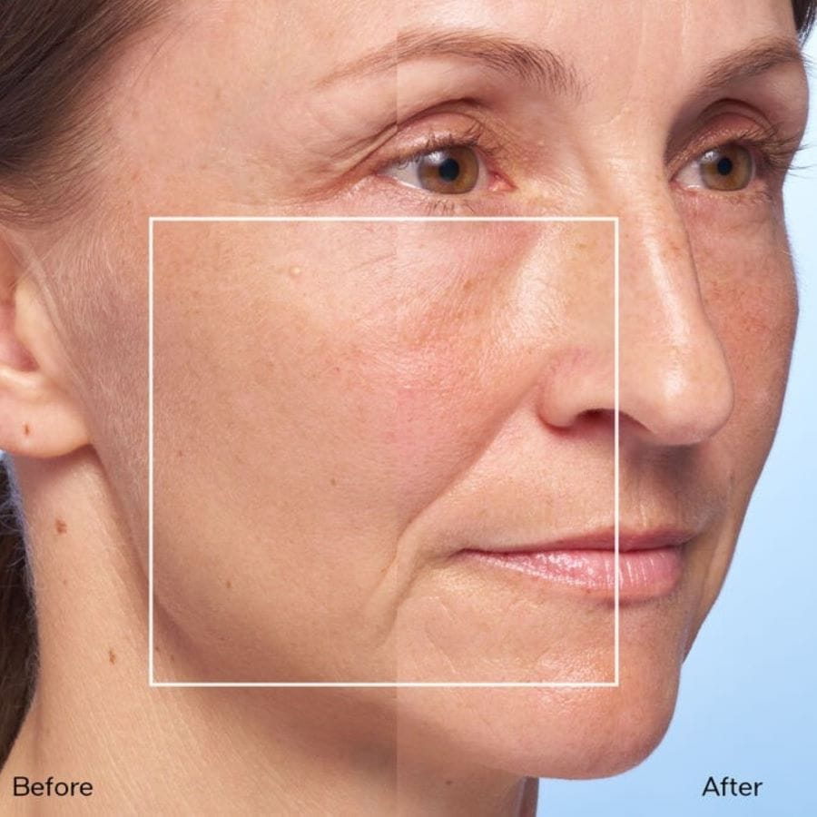 Bio-Performance Micro-Click Concentrate