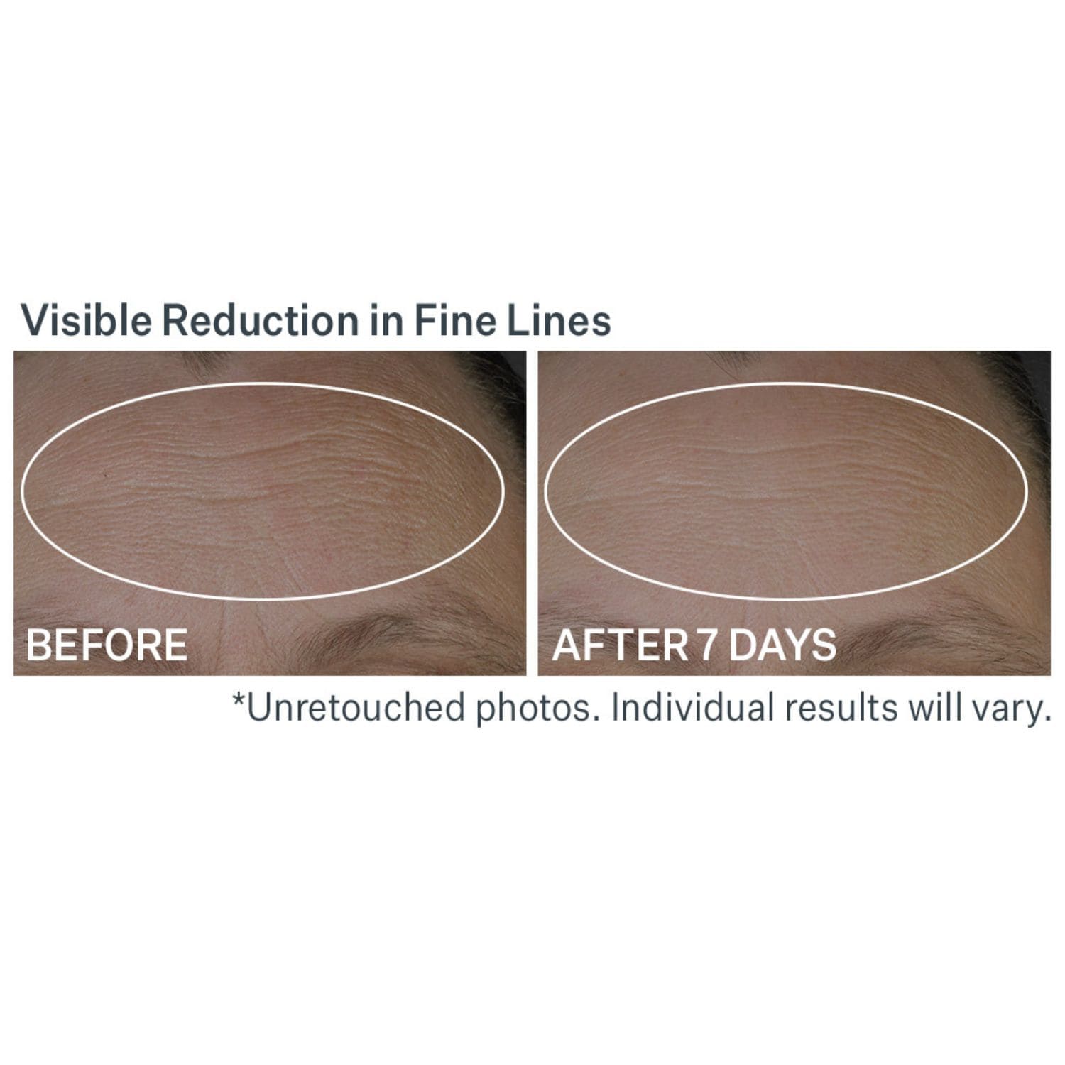 Peptide Plump™ Line Filling Bounce Serum