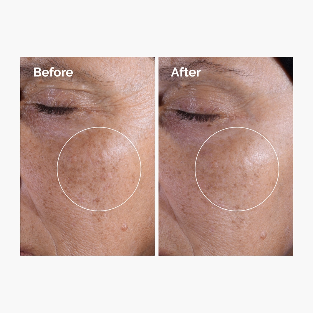 Glycolic Acid 7% Exfoliating Toner